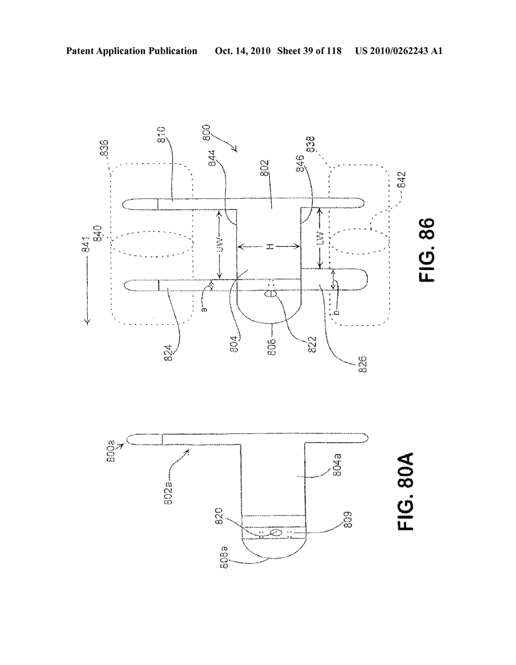 SPINE DISTRACTION IMPLANT - diagram, schematic, and image 41