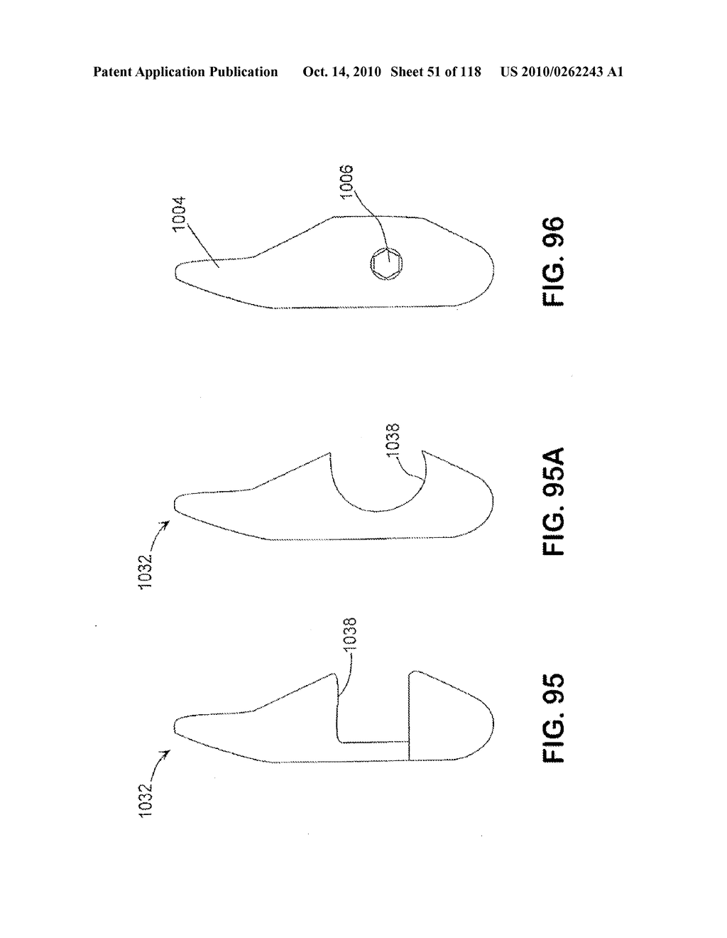 SPINE DISTRACTION IMPLANT - diagram, schematic, and image 53