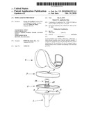 Modular Knee Prosthesis diagram and image