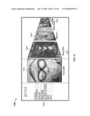 SYSTEMS AND METHODS FOR GENERATING A MEDIA GUIDANCE APPLICATION WITH MULTIPLE PERSPECTIVE VIEWS diagram and image