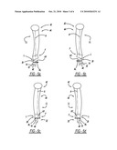 FOREFOOT WEDGE INSERT FOR FOOTWEAR diagram and image