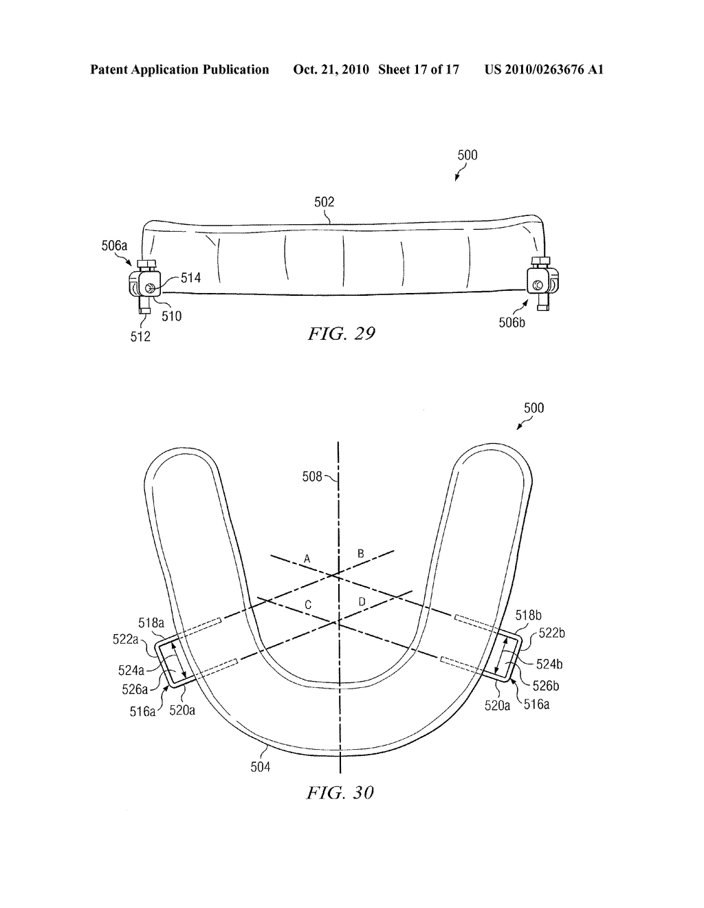 Oral Appliance for Treating a Breathing Condition - diagram, schematic, and image 18