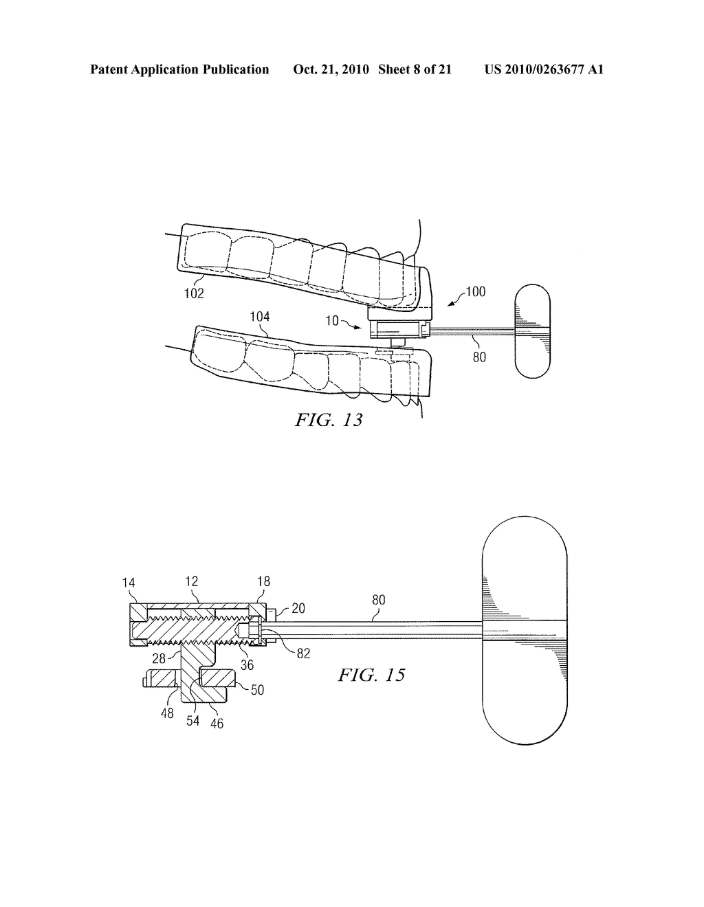 System for Coupling an Oral Appliance to a Medical Mask - diagram, schematic, and image 09