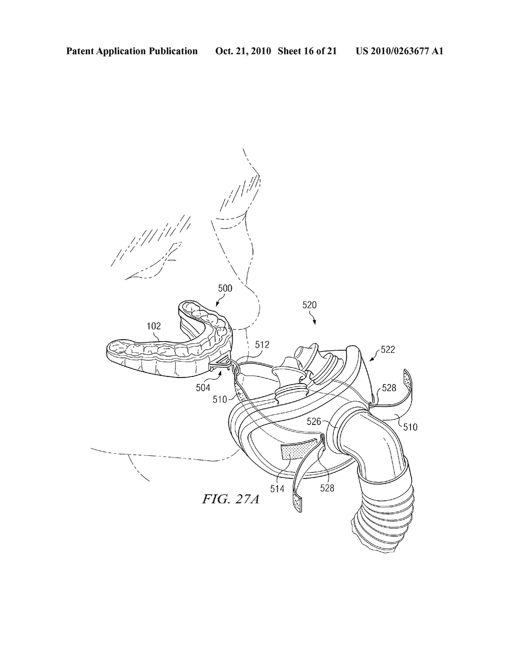 System for Coupling an Oral Appliance to a Medical Mask - diagram, schematic, and image 17