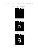 MAGNETIC RESONANCE METHOD AND APPARATUS WITH DISPLAY OF DATA ACQUISITION PROGRESS FOR A SUBJECT CONTINUOUSLY MOVING THROUGH THE APPARATUS diagram and image