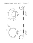 GONIOSCOPE FOR IMPROVED VIEWING diagram and image