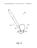 GONIOSCOPE FOR IMPROVED VIEWING diagram and image