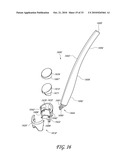 GONIOSCOPE FOR IMPROVED VIEWING diagram and image