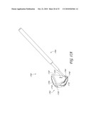 GONIOSCOPE FOR IMPROVED VIEWING diagram and image