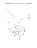 GONIOSCOPE FOR IMPROVED VIEWING diagram and image