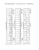 INTERFEROMETER AND METHOD FOR MEASURING CHARACTERISTICS OF OPTICALLY UNRESOLVED SURFACE FEATURES diagram and image