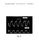 THERMAL LENS FORMING ELEMENT diagram and image