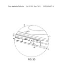 SUPPORT TABS FOR PROTECTING A CIRCUIT BOARD FROM APPLIED FORCES diagram and image