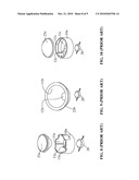 ADJUSTABLE CONDENSER SEAT diagram and image