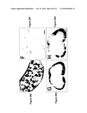 PROSTATIC ACID PHOSPHATASE FOR THE TREATMENT OF PAIN diagram and image