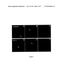 D1-1 NUCLEIC ACIDS, POLYPEPTIDES AND RELATED METHODS diagram and image