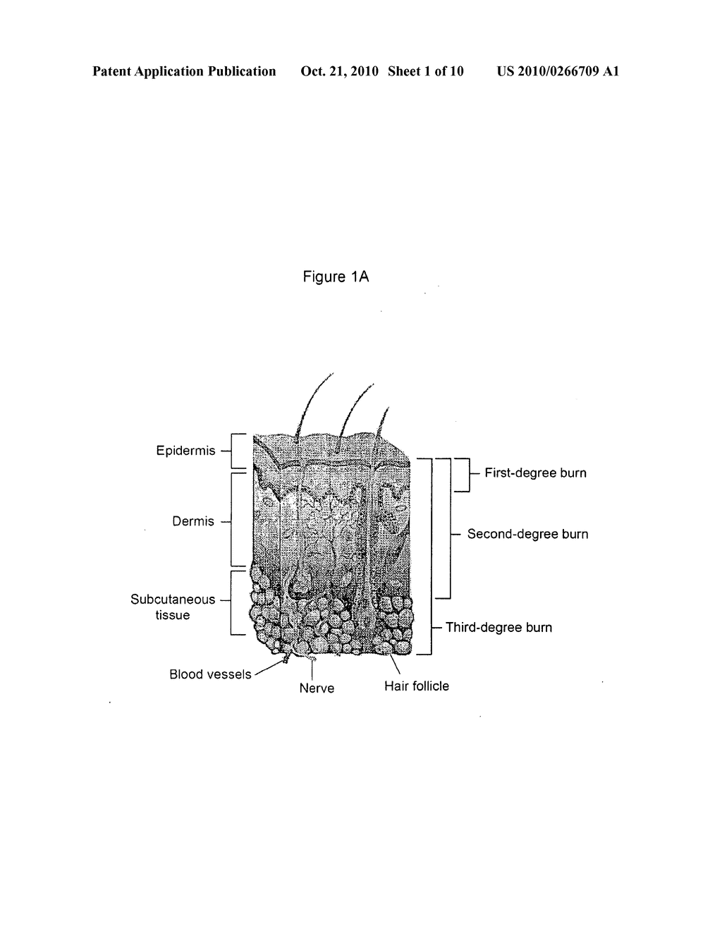 Compositions and Methods for Treating Burns - diagram, schematic, and image 02