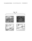 METHODS AND KIT FOR ENDOMETRIOSIS SCREENING diagram and image