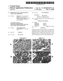 PREDICTING LUNG CANCER SURVIVAL USING GENE EXPRESSION diagram and image