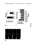 Regulators Of Fat Metabolism As Anti-Cancer Targets diagram and image