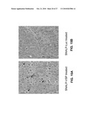 LIPID FORMULATED COMPOSITIONS AND METHODS FOR INHIBITING EXPRESSION OF Eg5 AND VEGF GENES diagram and image