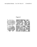 METHODS AND COMPOSITIONS FOR TREATING NEUROLOGICAL DISEASE diagram and image