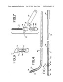 METHODS AND APPARATUS FOR INTRAOCULAR BRACHYTHERAPY diagram and image