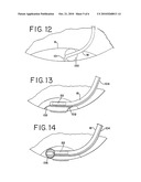 METHODS AND APPARATUS FOR INTRAOCULAR BRACHYTHERAPY diagram and image