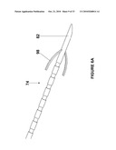 BRACHYTHERAPY FIDUCIAL NEEDLE FIXATION SYSTEM AND METHOD diagram and image