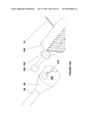 BRACHYTHERAPY FIDUCIAL NEEDLE FIXATION SYSTEM AND METHOD diagram and image