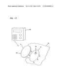 Analyte Monitoring Device and Methods of Use diagram and image