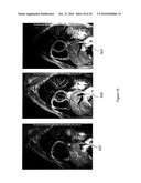  System for Automated Parameter Setting in Cardiac Magnetic Resonance Imaging diagram and image