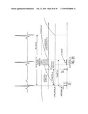  System for Automated Parameter Setting in Cardiac Magnetic Resonance Imaging diagram and image