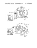 Head-stabilized medical apparatus, system and methodology diagram and image