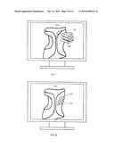 MODULAR CUSTOM BRACES, CASTS AND DEVICES AND METHODS FOR DESIGNING AND FABRICATING diagram and image