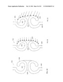 MODULAR CUSTOM BRACES, CASTS AND DEVICES AND METHODS FOR DESIGNING AND FABRICATING diagram and image