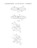 MODULAR CUSTOM BRACES, CASTS AND DEVICES AND METHODS FOR DESIGNING AND FABRICATING diagram and image