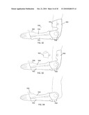 MODULAR CUSTOM BRACES, CASTS AND DEVICES AND METHODS FOR DESIGNING AND FABRICATING diagram and image