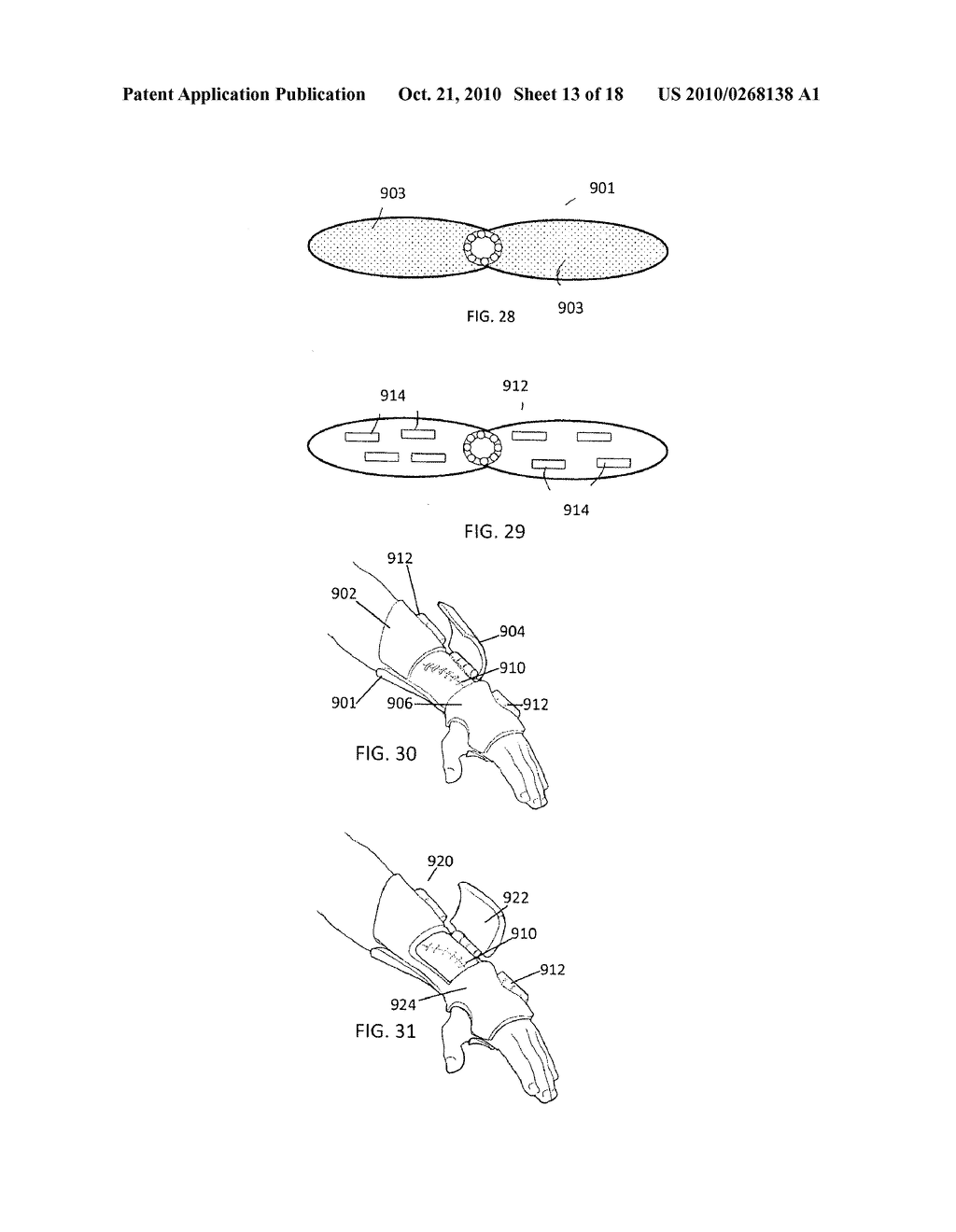 CUSTOM BRACES, CASTS AND DEVICES HAVING LIMITED FLEXIBILITY AND METHODS FOR DESIGNING AND FABRICATING - diagram, schematic, and image 14