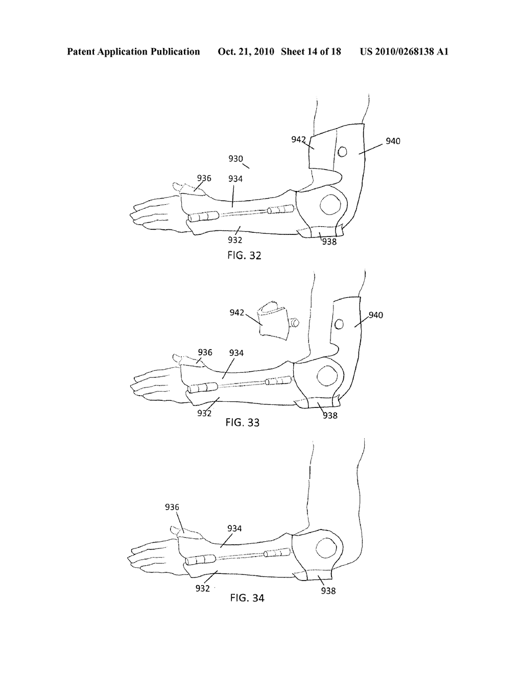 CUSTOM BRACES, CASTS AND DEVICES HAVING LIMITED FLEXIBILITY AND METHODS FOR DESIGNING AND FABRICATING - diagram, schematic, and image 15