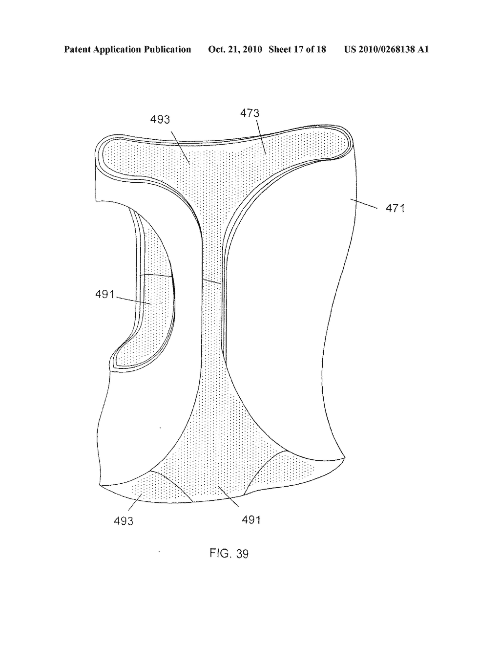 CUSTOM BRACES, CASTS AND DEVICES HAVING LIMITED FLEXIBILITY AND METHODS FOR DESIGNING AND FABRICATING - diagram, schematic, and image 18