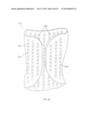 CUSTOM BRACES, CASTS AND DEVICES HAVING LIMITED FLEXIBILITY AND METHODS FOR DESIGNING AND FABRICATING diagram and image
