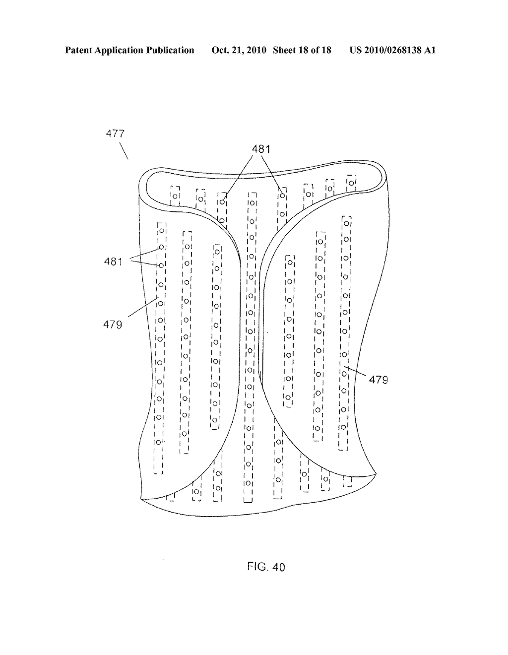 CUSTOM BRACES, CASTS AND DEVICES HAVING LIMITED FLEXIBILITY AND METHODS FOR DESIGNING AND FABRICATING - diagram, schematic, and image 19