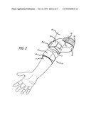 ELBOW BRACE FOR PREVENTING OR ATTENUATING TENNIS ELBOW diagram and image