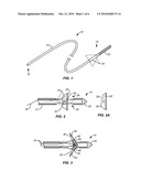 SYSTEM AND METHOD FOR DELIVERING EXPANDING TROCAR THROUGH A SHEATH diagram and image