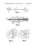 Drug Delivery Catheter using Frangible Microcapsules and Delivery Method diagram and image