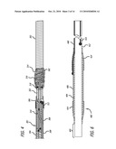 Implant Delivery System diagram and image