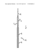 Implant Delivery System diagram and image