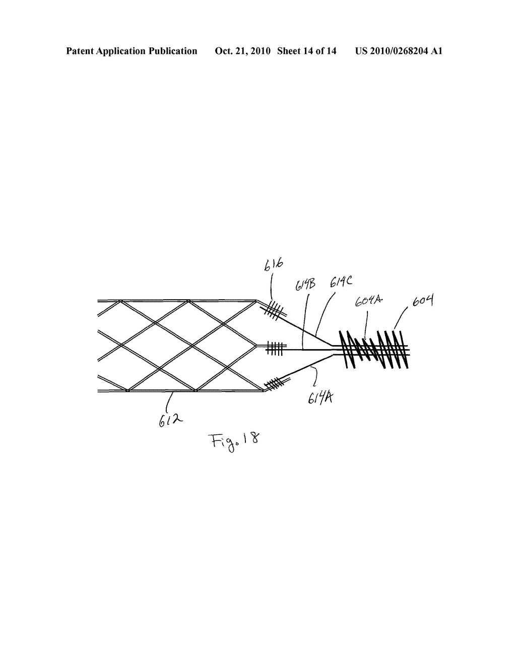 Implant Delivery System - diagram, schematic, and image 15