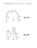 Inductively heated snare diagram and image